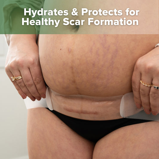 Haakaa Mum C-Section Scar Silicone Patches - 6pcs (3 x 0.5mm + 3 x 1mm)