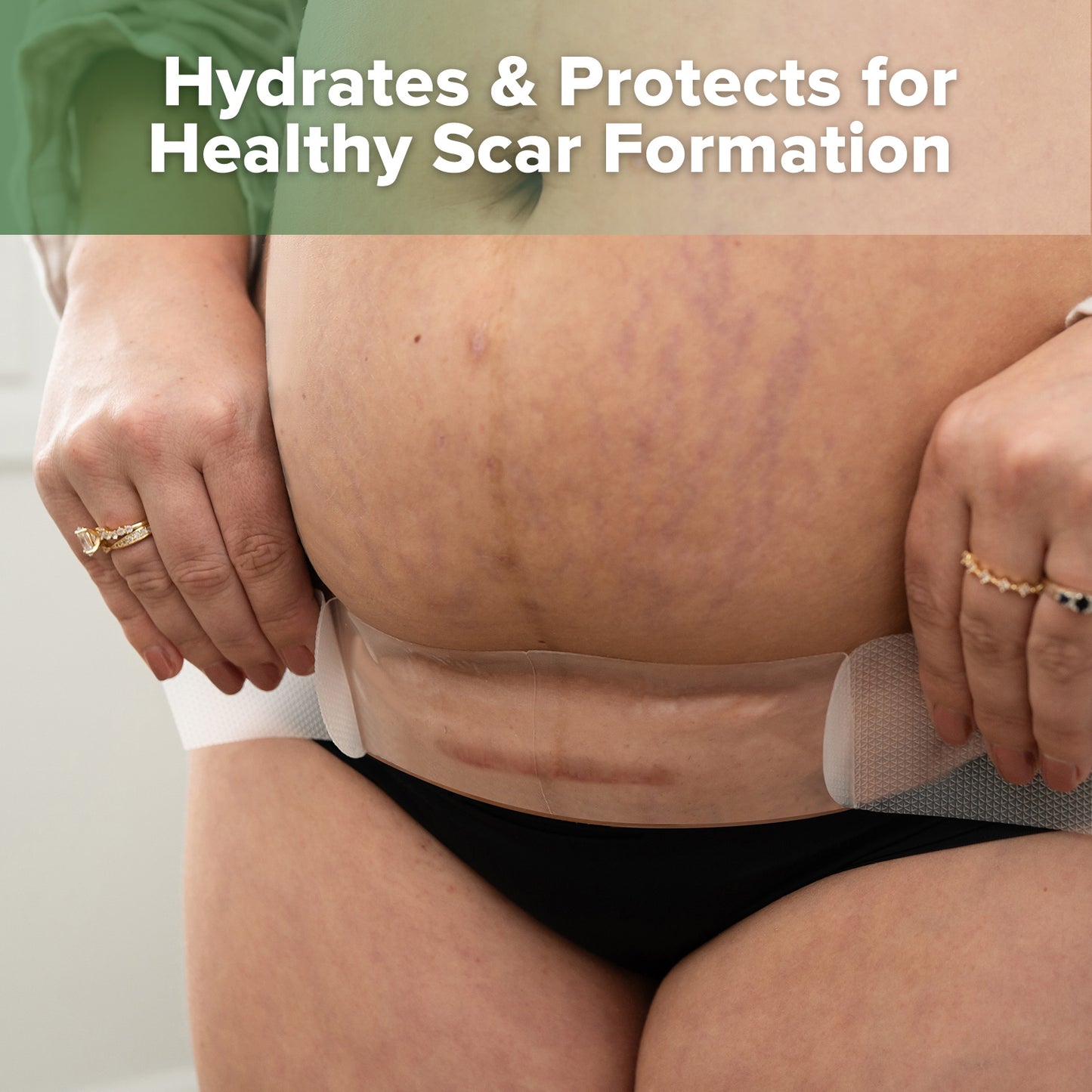 Haakaa Mum C-Section Scar Silicone Patches - 6pcs (3 x 0.5mm + 3 x 1mm)