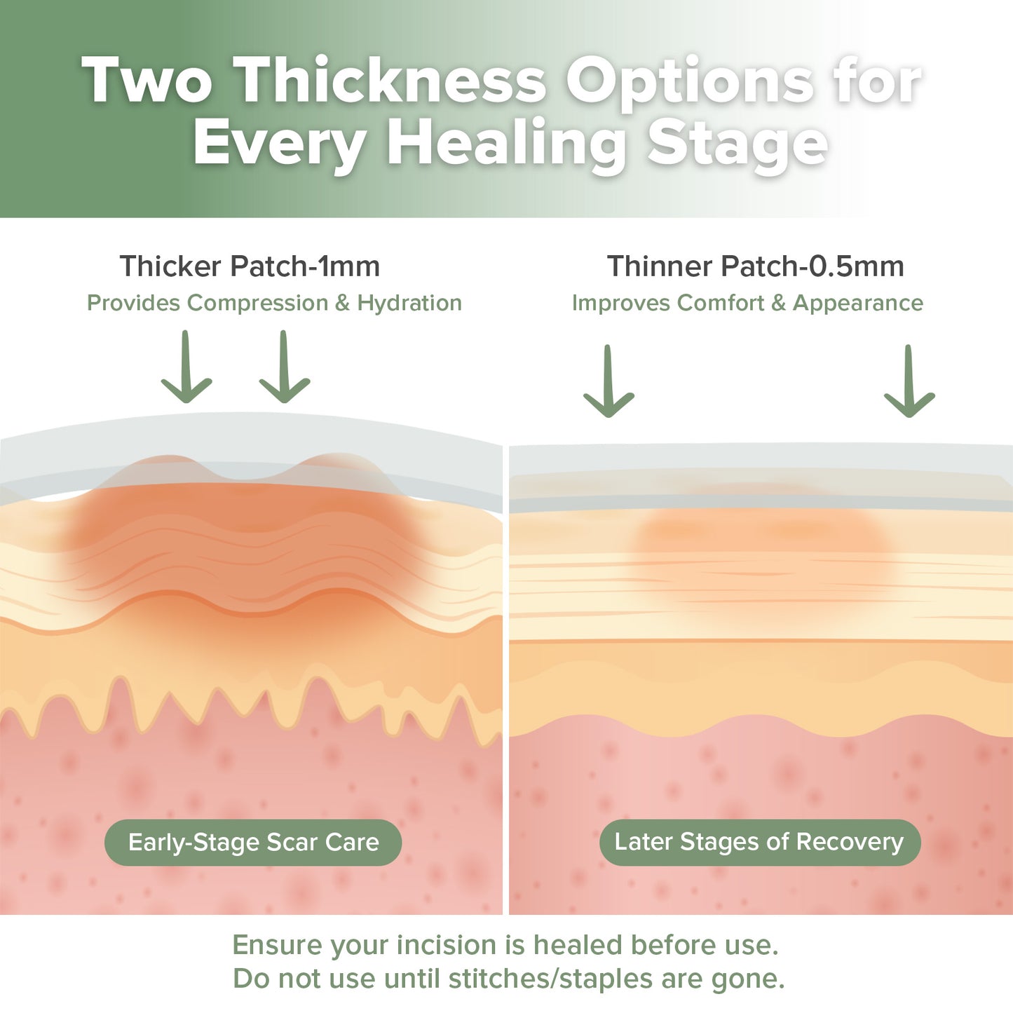 Haakaa Mum C-Section Scar Silicone Patches - 6pcs (3 x 0.5mm + 3 x 1mm)