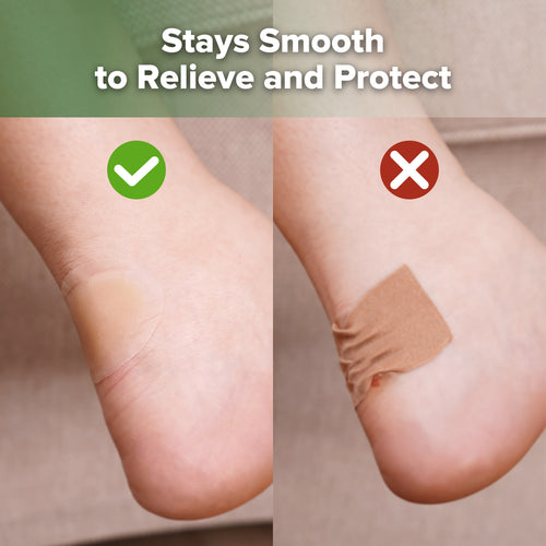 Gel Blister Pad Variety Pack - 36pcs